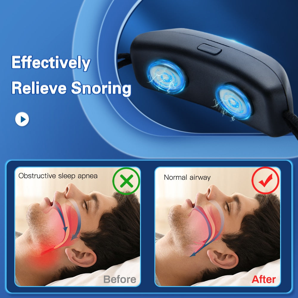 Smart Anti-Snoring Device - EMS Pulse Stop Snore